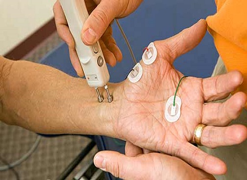 Nerve Conduction Study